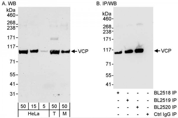 Anti-VCP