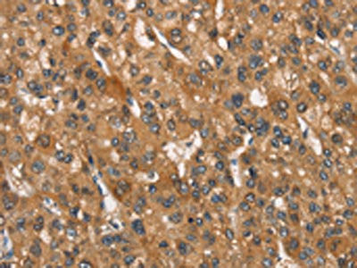 Anti-APOA1BP