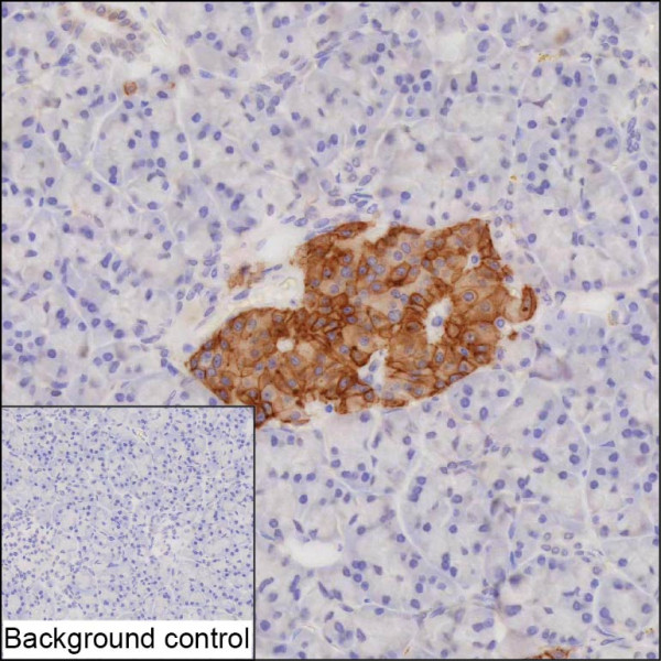 Anti-SSTR2 Recombinant