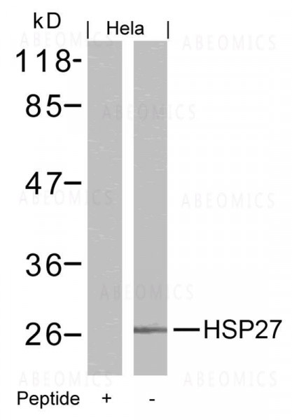 Anti-HSP27 (Ab-15)