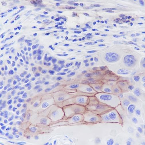 Anti-Recombinant Thrombomodulin, clone A376