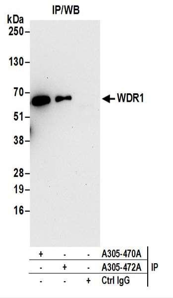 Anti-WDR1
