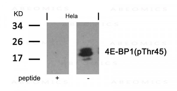 Anti-phospho-4E-BP1 (Thr45)