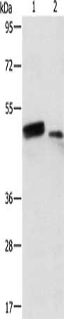 Anti-RARB