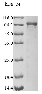 Interleukin-1 receptor-associated kinase 3 (Irak3), mouse, recombinant