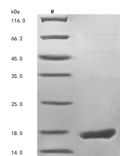 Fragile X mental retardation 1 neighbor protein (FMR1NB), partial, human, recombinant