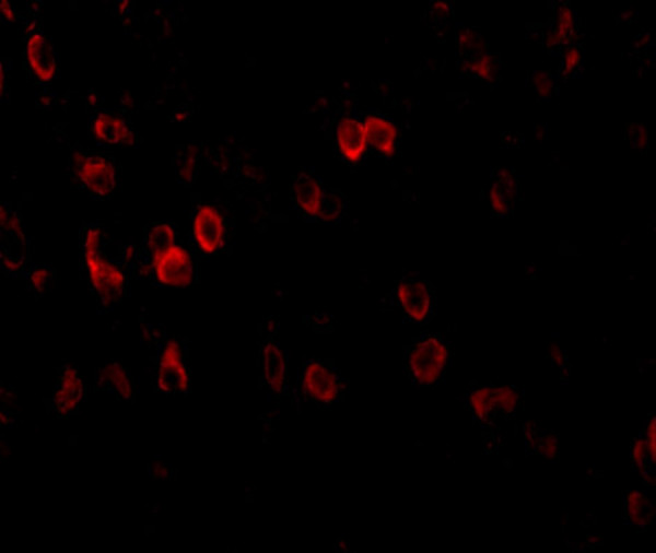 Anti-Amyloid Precursor Protein