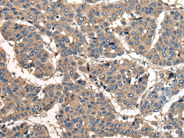 Anti-CORO1B