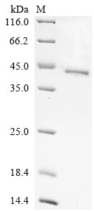 Protein Wnt-4 (WNT4), human, recombinant