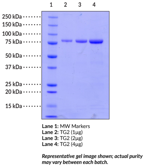 Transglutaminase 2 (human, recombinant)