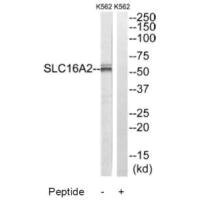 Anti-SLC16A2