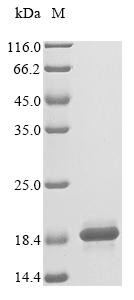 Cyclin-dependent kinases regulatory subunit 2 (CKS2), human, recombinant
