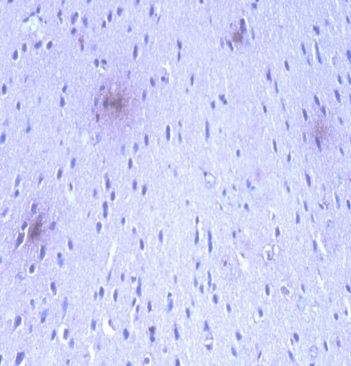 Anti-Amyloid beta Peptide 42 [CA9 3F8], clone CA9 3F8