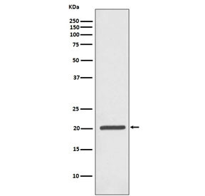 Anti-FTH1 / Ferritin heavy chain, clone FBA-6