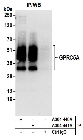 Anti-GPRC5A