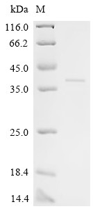 FERM, ARHGEF and pleckstrin domain-containing protein 2 (FARP2), partial, human, recombinant
