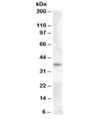 Anti-Proenkephalin
