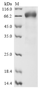 Interleukin-15 receptor subunit alpha (IL15RA), partial, human, recombinant