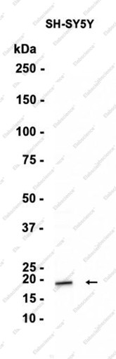 Anti-Recombinant Midkine, clone C312920