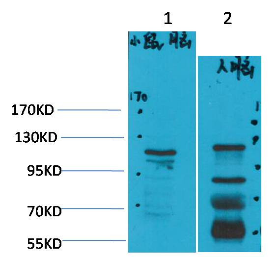 Anti-CaValpha2delta3