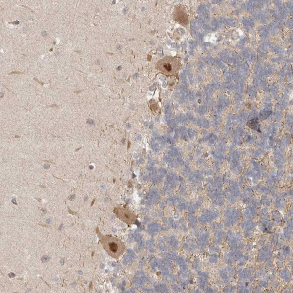 Anti-PSMA5