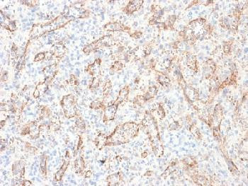 Anti-TNFS15 / VEGI (Vascular Endothelial Growth Inhibitor) Recombinant Mouse Monoclonal Antibody (cl