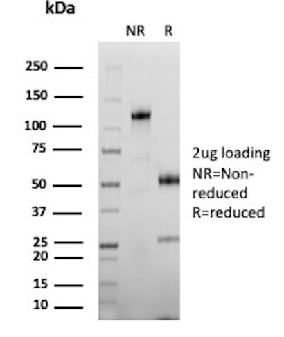 Anti-Carcinoembryonic Antigen (CEA) / CD66, clone C66/1292