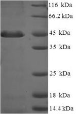 Proteasome inhibitor PI31 subunit (PSMF1), human, recombinant