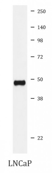 Anti-Urokinase / uPA