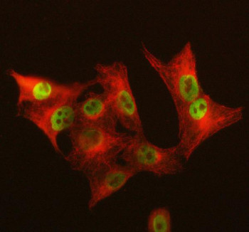 Anti-GALNT12 / Polypeptide N-acetylgalactosaminyltransferase 12