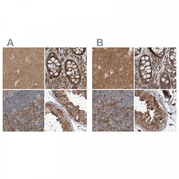 Anti-ARHGEF11