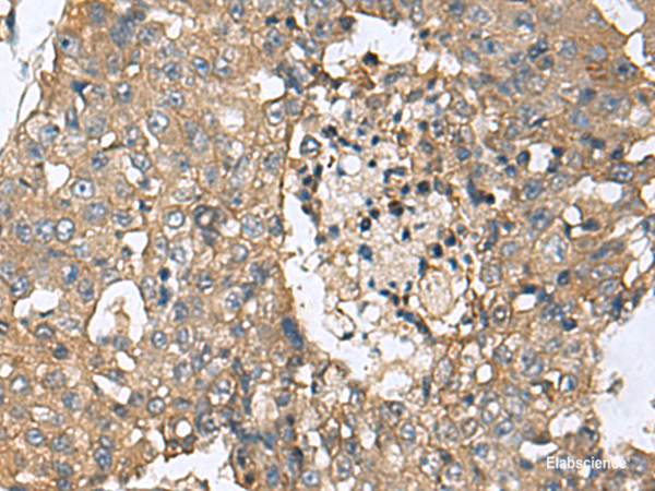 Anti-CD59
