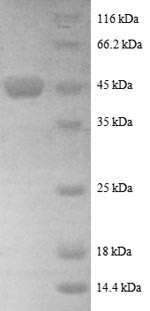 ADP-ribosylation factor-like protein 2 (ARL2), partial, human, recombinant