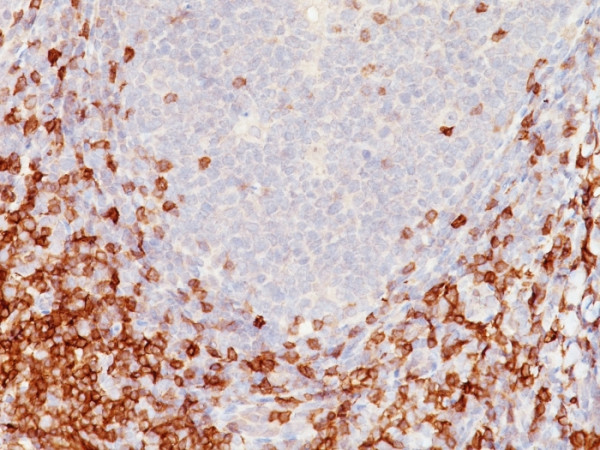 Anti-CD5 (Mantle Cell Lymphoma Marker), clone C5/473