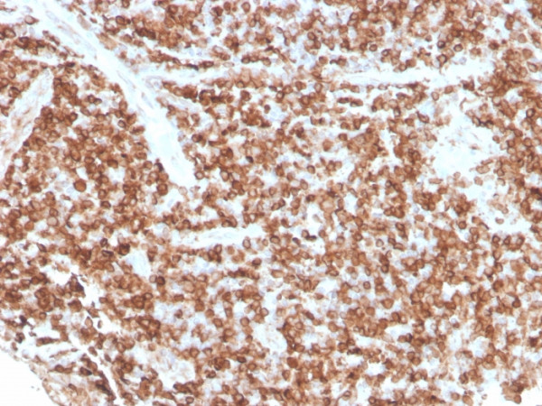 Anti-CD74 (B-Cell Marker), recombinant antibody, clone rCLIP/813