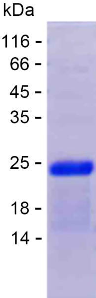 Recombinant Human SPATA6 Protein