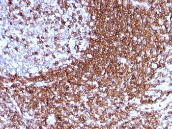 Anti-CD50 / ICAM3 Monoclonal Antibody (Clone: 186-2G9)