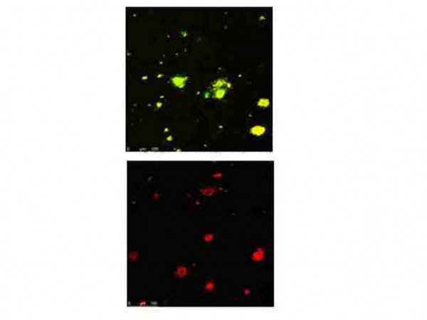 Anti-Beta Amyloid pyro E3