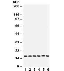 Anti-Superoxide Dismutase 1 (SOD1)