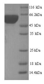60 kDa chaperonin (groL), Yersinia pestis, recombinant