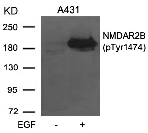 Anti-phospho-NMDAR2B (Tyr1474)