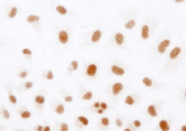 Anti-HIF1-alpha (IHC)