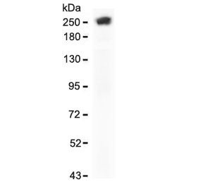 Anti-SPTA1 / Spectrin alpha 1, clone SCNA-1R