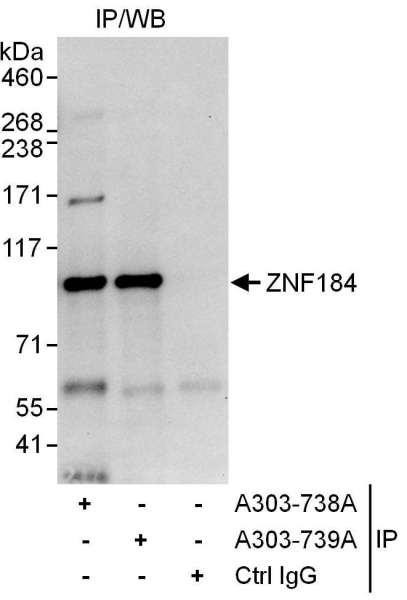 Anti-ZNF184