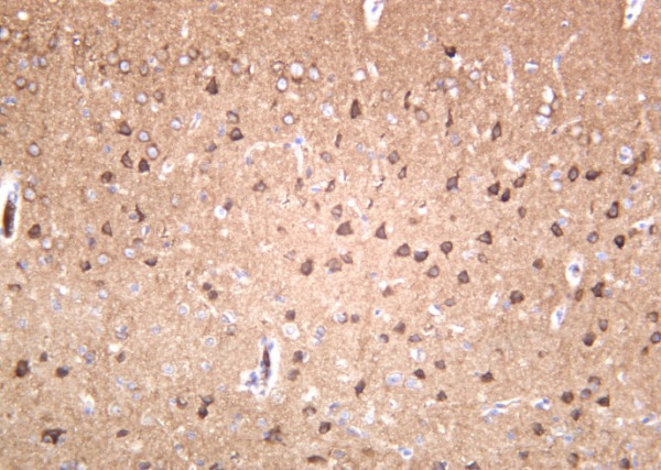 Anti-Recombinant GluR-2, clone 9B1