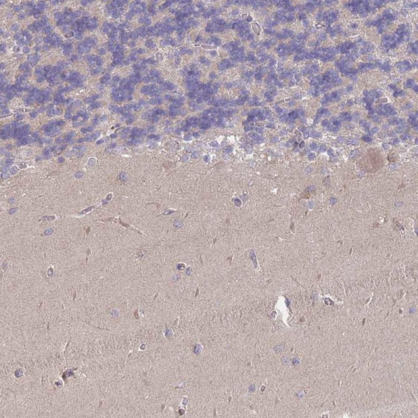 Anti-MRPS18B