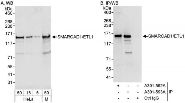 Anti-SMARCAD1/ETL1