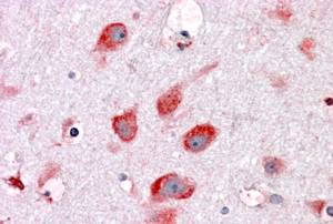 Anti-Ribosomal protein L22, C-terminal