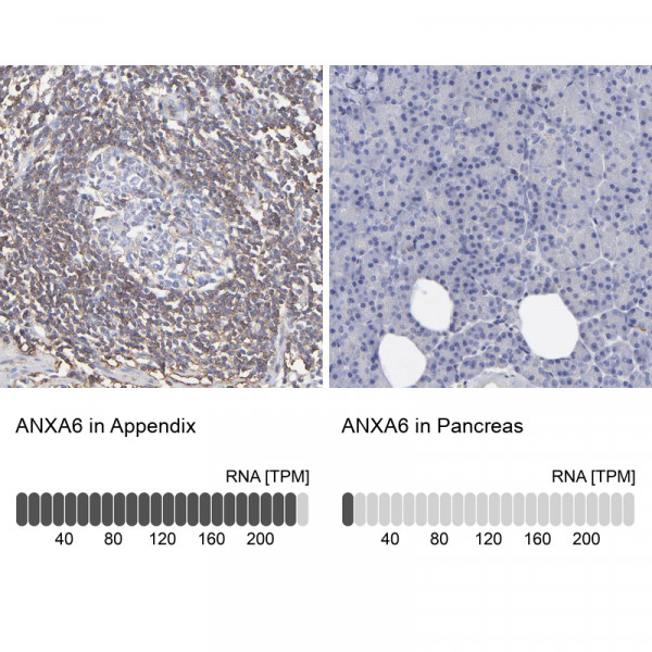 Anti-ANXA6