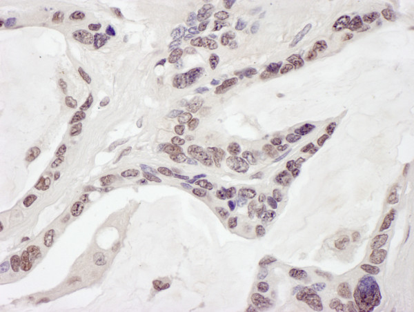 Anti-ARID1B